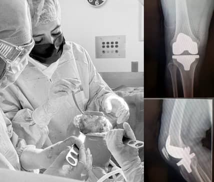 Slider image (4) Dr. Metztli Linette Gomez Espinoza - Orthopedic Clinic